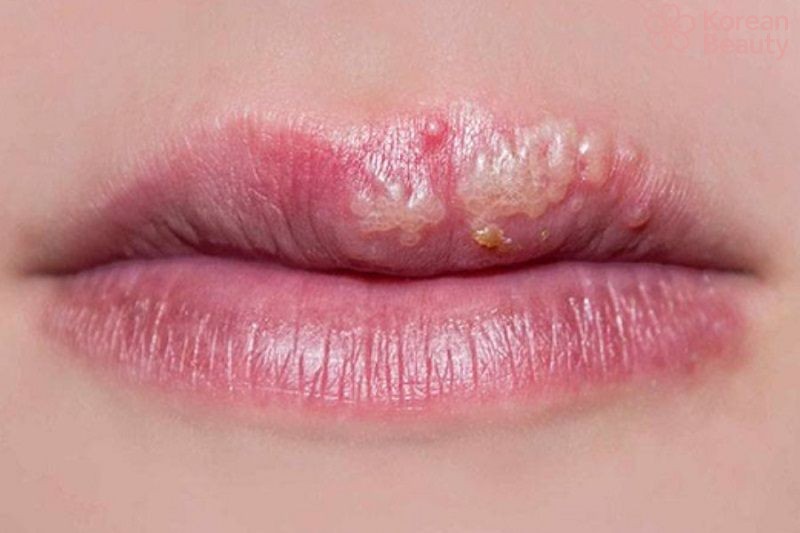 Những dấu hiệu phun môi bị hỏng phổ biến nhất