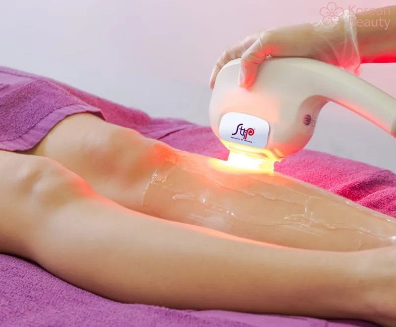Những lợi ích của công nghệ triệt lông AFT mang đến cho người dùng