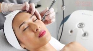 Quy trình thực hiện xóa nốt ruồi bằng laser và thời gian hồi phục