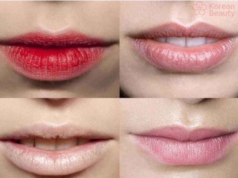 Cách nhận biết sớm các dấu hiệu phun môi bị hỏng