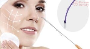 Những đặc điểm của phương pháp nâng mũi bằng chỉ