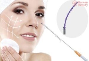 Những đặc điểm của phương pháp nâng mũi bằng chỉ