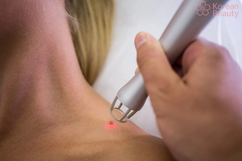 Những rủi ro có thể gặp phải và lưu ý quan trọng khi thực hiện