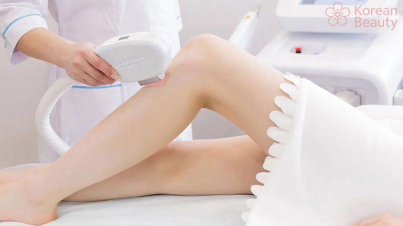 Quy trình sử dụng chi tiết máy triệt lông IPL đúng kỹ thuật