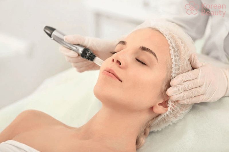 Những lưu ý quan trọng khi sử dụng kem tái tạo da sau khi bắn laser