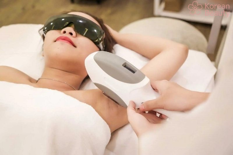 Những vấn đề liên quan đến công nghệ triệt lông IPL
