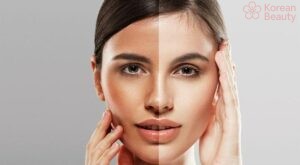 Cách thực hiện đối phó da bị tăng sắc tố trong các trường hợp đặc biệt