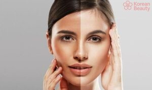 Cách thực hiện đối phó da bị tăng sắc tố trong các trường hợp đặc biệt