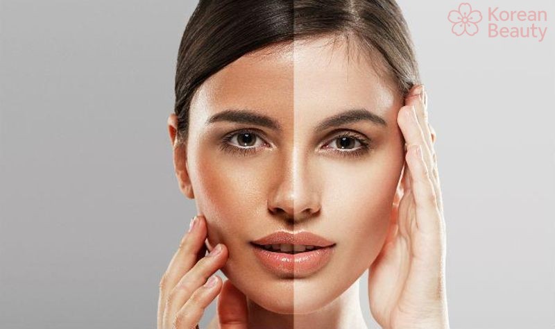 Cách thực hiện đối phó da bị tăng sắc tố trong các trường hợp đặc biệt