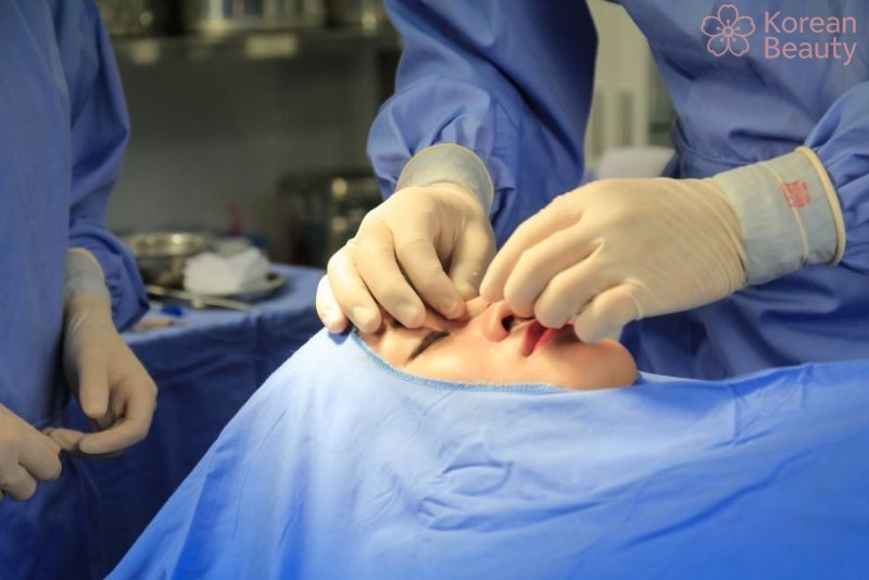 Những kinh nghiệm giúp lựa chọn những địa chỉ nâng mũi uy tín tại Sài Gòn hiệu quả